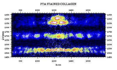 [Processed collagen 2-D Fiber diffraction pattern]