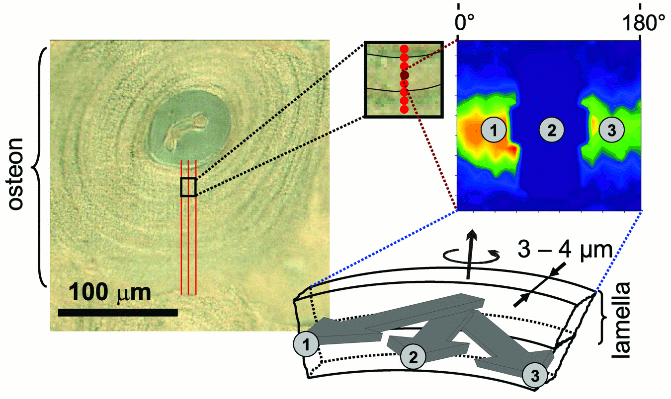 [Bone lamelae]